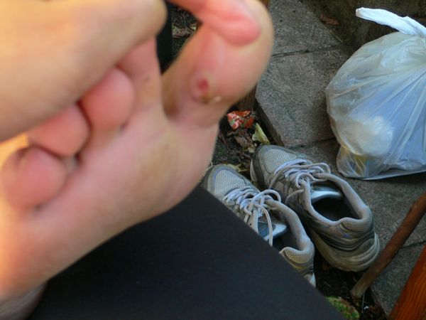 Sentimos los primeros estragos - ampollas y dolores en la rodilla -  